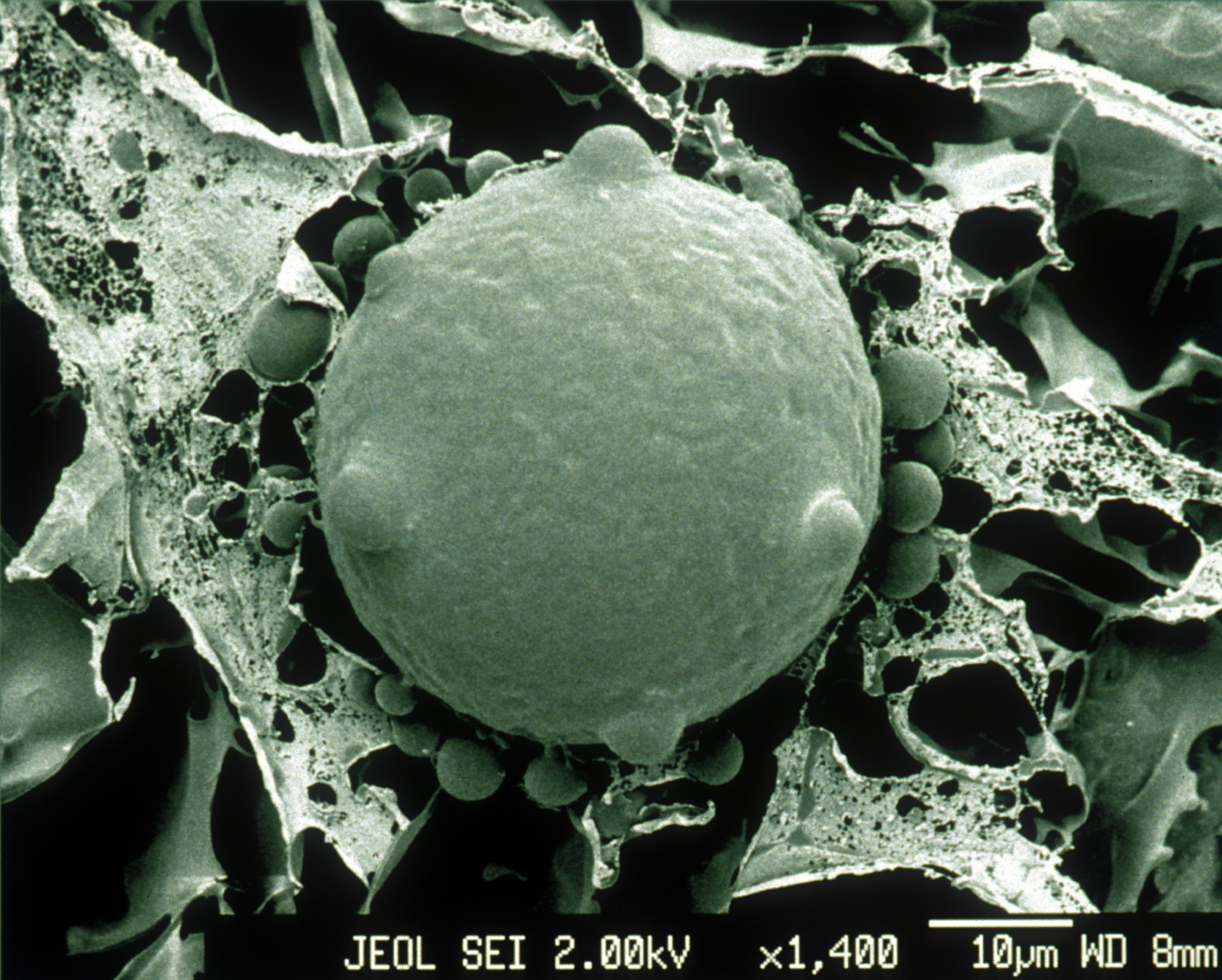 CSIRO_ScienceImage_1392_Scanning_Electron_Micrograph_of_Chytrid_Fungus.jpg